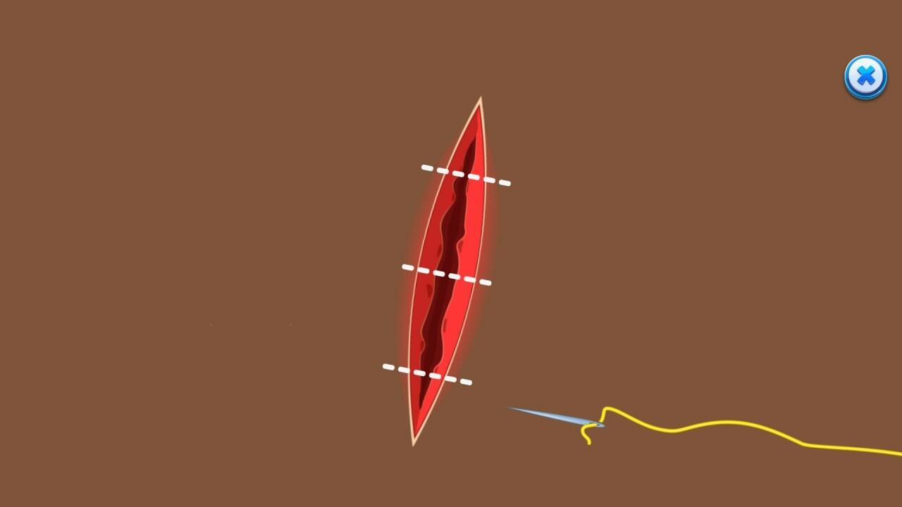 Fix My Legs Doc ستيم كود رقمي